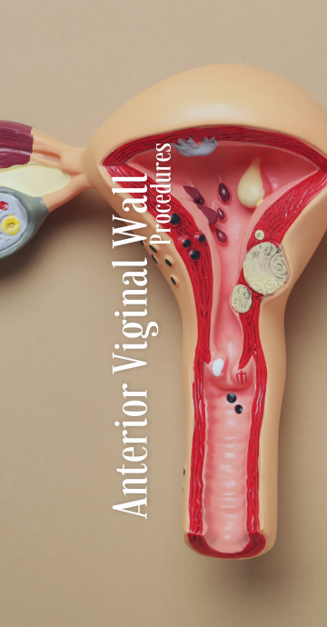 Procedures on anterior viginal wall